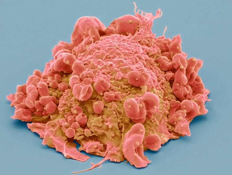 Unlocking the Secrets of Cancer: How Cell Atlases Are Revolutionizing Our Understanding