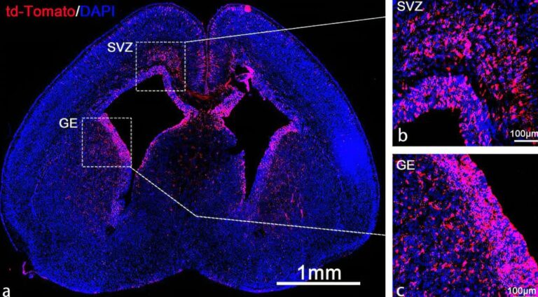 Faulty genes fixed before birth